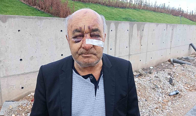 Öldüresiye dövülen taksici korku dolu o anları