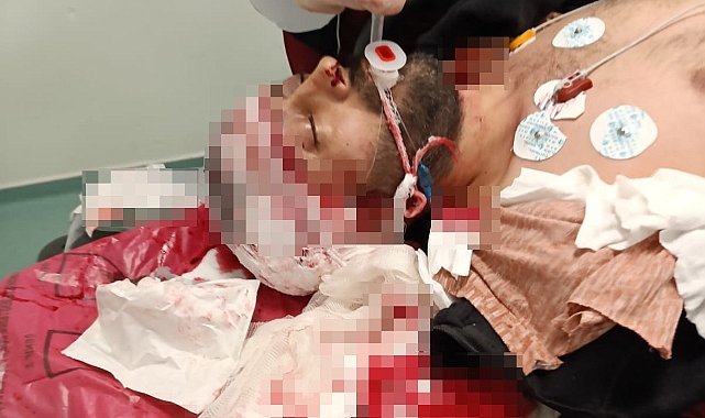 Önce bacağına sonra kafasına sıktı: Dehşet anları kamerada