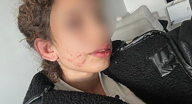 Konya'da 19 yaşındaki kızı darp eden gençten "kendi kendini yaraladı" savunması