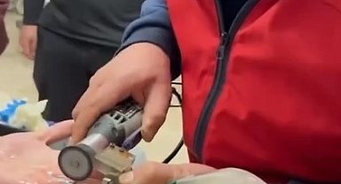 Parmağına sıkışan yüzüğü itfaiye çıkardı