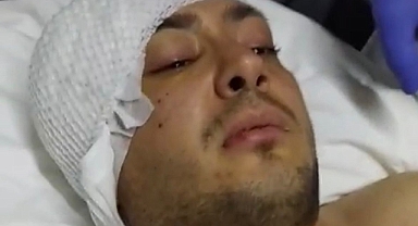 Uzman çavuşun inanılmaz kurtuluşu...İlk sözleri anlamlı