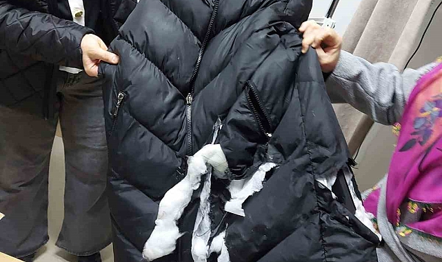 Köpeklerin saldırısına uğrayan kadın yaralandı: O anlar kameraya yansıdı