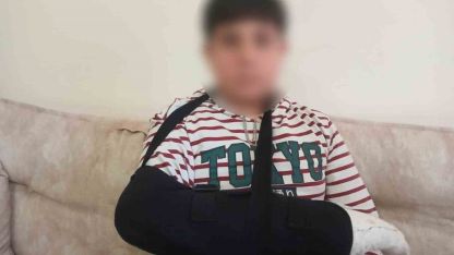 Ankara’da ortaokul öğrencisi, kendisinden 3 yaş küçük öğrencinin parmağını kırdı