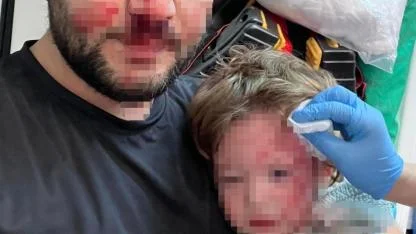 Komşu Saldırısı Dehşeti: Babanın Burnu Kırıldı, 14 Aylık Bebeğin Kafatası Çatladı