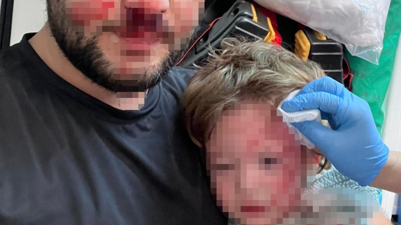 Komşu Saldırısı Dehşeti: Babanın Burnu Kırıldı, 14 Aylık Bebeğin Kafatası Çatladı